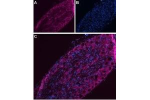 Immunohistochemistry (IHC) image for anti-Sodium Channel, Voltage-Gated, Type IX, alpha Subunit (SCN9A) (AA 446-460), (Intracellular) antibody (Atto 633) (ABIN7043648)