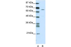 WB Suggested Anti-ZNF205 Antibody Titration:  5. (ZNF205 antibody  (N-Term))