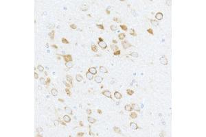 Immunohistochemistry of paraffin-embedded rat brain using Phospho-S6 Ribosomal Protein (RPS6)-S240/244 Rabbit pAb (ABIN6135311, ABIN6136242, ABIN6136243 and ABIN6225563) at dilution of 1:50 (40x lens). (RPS6 antibody  (pSer240, pSer244))