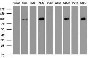 Image no. 1 for anti-Cadherin 1, Type 1, E-Cadherin (Epithelial) (CDH1) antibody (ABIN1497942) (E-cadherin antibody)