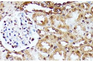 Immunohistochemistry of paraffin-embedded Rat kidney using YAP1 Polyclonal Antibody at dilution of 1:100 (40x lens). (YAP1 antibody)