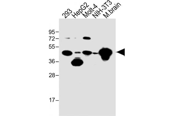 STRADA anticorps  (C-Term)