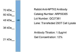 WB Suggested Anti-NPTX2  Antibody Titration: 0. (NPTX2 antibody  (N-Term))