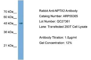 WB Suggested Anti-NPTX2  Antibody Titration: 0.