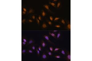 Immunofluorescence analysis of U-2 OS cells using RBM39 antibody (ABIN7270085) at dilution of 1:100. (RBM39 antibody  (C-Term))