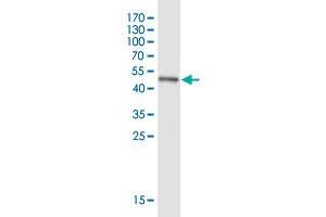 Western Blot detection against Immunogen (47 KDa) . (SPAG16 antibody  (AA 1-183))