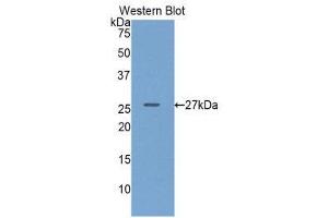 Western Blotting (WB) image for anti-Glucuronidase, beta (GUSB) (AA 451-649) antibody (ABIN1859101) (Glucuronidase beta antibody  (AA 451-649))