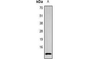 Western blot analysis of SPINK1 expression in mouse intestine (A) whole cell lysates. (SPINK1 antibody)
