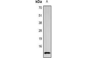Western blot analysis of SPINK1 expression in mouse intestine (A) whole cell lysates. (SPINK1 antibody)