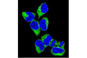 Confocal immunofluorescent analysis of GNAS Antibody (C-term) (ABIN656989 and ABIN2850497) with 293 cell followed by Alexa Fluor 488-conjugated goat anti-rabbit lgG (green).