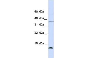 WB Suggested Anti-HSPE1 Antibody Titration: 0. (HSPE1 antibody  (Middle Region))