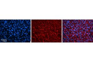 Rabbit Anti-ZNF259 Antibody   Formalin Fixed Paraffin Embedded Tissue: Human Liver Tissue Observed Staining: Cytoplasm in hepatocytes Primary Antibody Concentration: N/A Other Working Concentrations: 1:600 Secondary Antibody: Donkey anti-Rabbit-Cy3 Secondary Antibody Concentration: 1:200 Magnification: 20X Exposure Time: 0. (ZNF259 antibody  (N-Term))