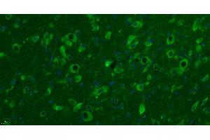 Paraformaldehyde-fixed, paraffin embedded rat brain, Antigen retrieval by boiling in sodium citrate buffer (pH6. (Dopamine d2 Receptor antibody  (AA 201-300) (AbBy Fluor® 488))