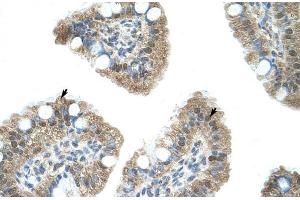 Human Intestine; NAB1 antibody - N-terminal region in Human Intestine cells using Immunohistochemistry (NAB1 antibody  (N-Term))