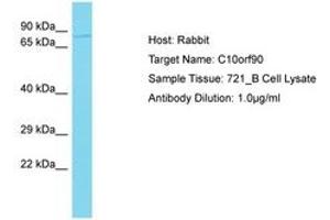 Image no. 1 for anti-Chromosome 10 Open Reading Frame 90 (C10ORF90) (AA 491-540) antibody (ABIN6750549) (C10ORF90 antibody  (AA 491-540))