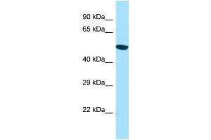 WB Suggested Anti-ACTR6 Antibody Titration: 1. (ACTR6 antibody  (C-Term))