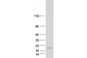 SMAGP Protein (Transcript Variant 1) (Myc-DYKDDDDK Tag)