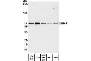 Western Blotting (WB) image for anti-Protein BANP (BANP) (C-Term) antibody (ABIN7453906) (BANP antibody  (C-Term))