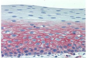 Immunohistochemistry staining of human tonsil (paraffin-embedded sections) with anti-CD82 (C33). (CD82 antibody)