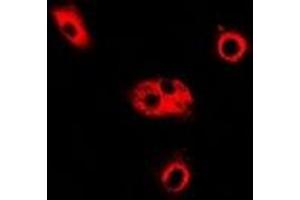 Immunofluorescent analysis of ADSL staining in Hela cells. (Adenylosuccinate Lyase antibody)