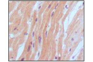 Immunohistochemical analysis of paraffin-embedded human normal myocardium, showing cytoplasmic localization using BNP2 mouse mAb with DAB staining.