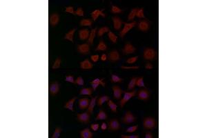 Immunofluorescence analysis of PC-3 cells using GSDMD (Full Length+N terminal) Rabbit pAb (ABIN7267351) at dilution of 1:150 (40x lens). (GSDMD antibody  (AA 154-252))