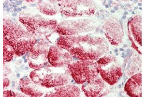 Rabbit Anti-Gyg antibody  Formalin Fixed Paraffin Embedded Tissue: Human Tonsil, Skeletal Myocytes Primary antibody Concentration: 1:100 Secondary Antibody: Donkey anti-Rabbit-Cy3 Secondary Antibody Concentration: 1:200 Magnification: 20x Exposure Time: 0. (GYG antibody  (C-Term))