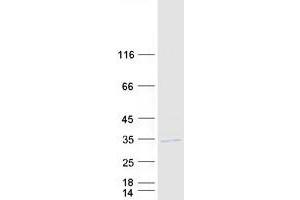 Validation with Western Blot (HSD17B8 Protein (Myc-DYKDDDDK Tag))