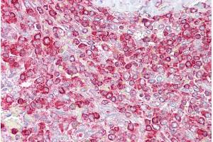 Immunohistochemistry with Spleen tissue at an antibody concentration of 5µg/ml using anti-GCLC antibody (ARP54577_P050) (GCLC antibody  (Middle Region))