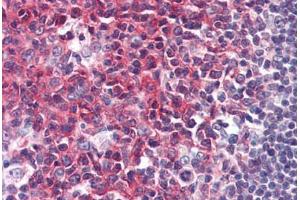 anti-phosphoprotein Associated with Glycosphingolipid Microdomains 1 (PAG1) (AA 235-280), (AA 97-432) antibody