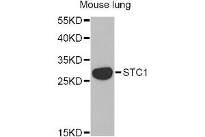 Western blot analysis of extracts of mouse lung, using STC1 Antibody (ABIN2560198) at 1:1000 dilution.