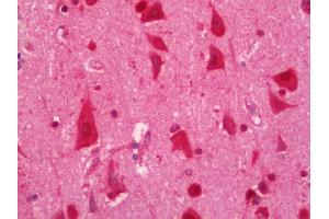 Human Brain, Cortex: Formalin-Fixed, Paraffin-Embedded (FFPE). (ELAVL2 antibody  (HRP))