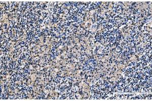 IHC analysis of CD9 using anti-CD9 antibody (ABIN7600001).