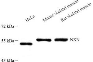 Western blot analysis of NXN (ABIN7074916),at dilution of 1: 1000