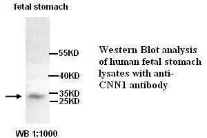 Image no. 1 for anti-Calponin antibody (ABIN790877) (Calponin antibody)