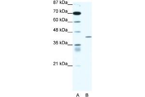 WB Suggested Anti-PPARD Antibody Titration:  1. (PPARD antibody  (Middle Region))
