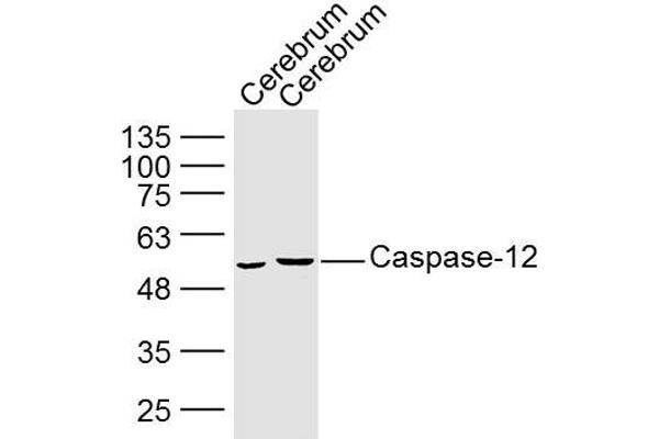 Caspase 12 抗体  (AA 201-300)