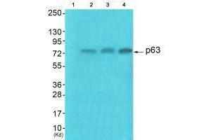 Western blot analysis of extracts from HuvEc cells (Lane 2), JK cells (Lane 3) and cos-7 cells (Lane4), using p63 antiobdy. (p63 antibody)