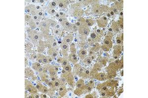 Immunohistochemistry of paraffin-embedded human liver injury using RNF166 antibody (ABIN5974659) (40x lens). (RNF166 antibody)