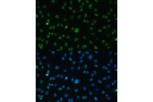Immunofluorescence analysis of C6 cells using HSF1 antibody (ABIN6131141, ABIN6142021, ABIN6142022 and ABIN6217875) at dilution of 1:100.
