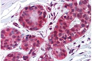 Human Breast (formalin-fixed, paraffin-embedded) stained with TIMP2 antibody ABIN214221 at 10 µg/ml followed by biotinylated anti-mouse IgG secondary antibody ABIN481714, alkaline phosphatase-streptavidin and chromogen. (TIMP2 antibody)