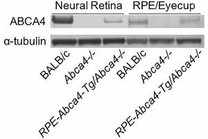 Immunoblot of retina and RPE homogenates from BALB/c, Abca4−/−, and RPE-Abca4-Tg/Abca4−/− mice (all albino) reacted with antisera against ABCA4 or alpha-tubulin. (ABCA4 antibody  (AA 2250-2263))