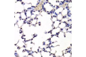 Immunohistochemistry of paraffin-embedded mouse lung using INTS6 Antibody.