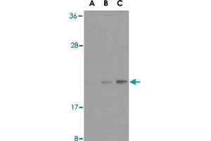 Western blot analysis of BAX in HL-60 cell lysates with BAX polyclonal antibody  at (A) 1, (B) 2, and (C) 4 ug/mL .