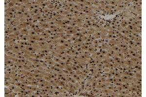 ABIN6273026 at 1/100 staining Mouse liver tissue by IHC-P. (YTHDF2 antibody  (Internal Region))