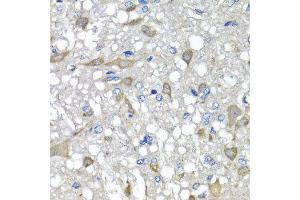 Immunohistochemistry of paraffin-embedded rat brain using C1GALT1C1 antibody at dilution of 1:100 (x40 lens). (C1GALT1C1 antibody)