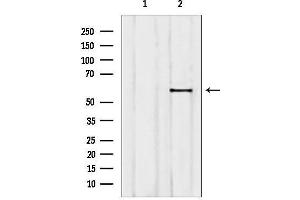 anti-Ets Variant 5 (ETV5) (Internal Region) antibody