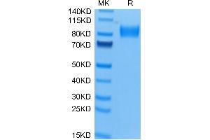 Osteoactivin Protein (GPNMB) (AA 23-486) (His tag)