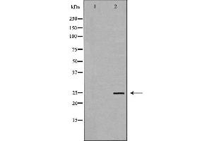 Western blot analysis of Hela whole cell lysates, using TK1 Antibody. (TK1 antibody  (N-Term))