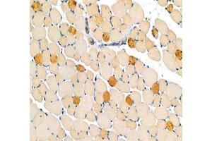 Immunohistochemistry analysis of paraffin-embedded mouse legmuscle using MYH7 (ABIN7075623) at dilution of 1: 100 (Slow Skeletal Myosin Heavy Chain antibody)